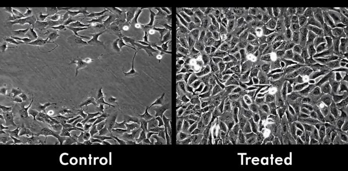 Nanopartikel beschleunigen die Wundheilung um die Hälfte