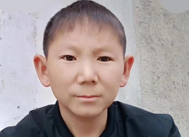Mit 34 sieht ein Chinese wie ein Sechsjähriger aus: Nachdem er sich den Kopf geschlagen hat, hat ein Mann aufgehört, erwachsen zu werden.