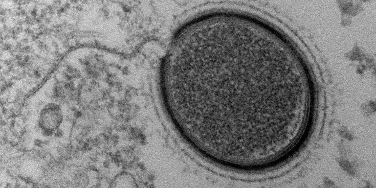 Ein uraltes gefährliches Virus, das im Permafrost Sibiriens gefunden wurde