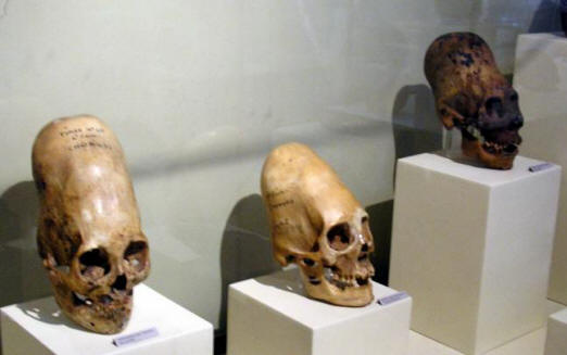 Die länglichen Schädel aus der Paracas-Wüste hatten eine seltsame DNA.